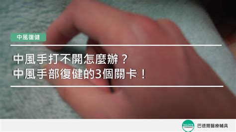 手張不開|【中風復健】中風手打不開怎麼辦？〡中風手部復健的3個關卡！。